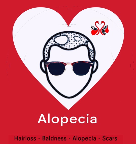 08. Alopecia.HC