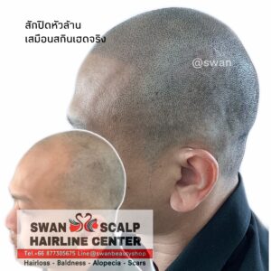 สัก SMP ที่ไหนดีH03