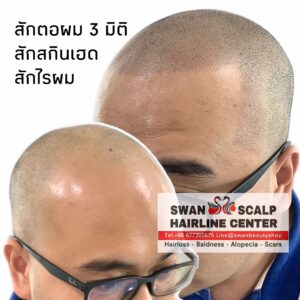 สักตอผม 3 มิติH07