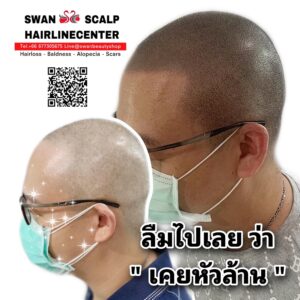 สักทรงสกินเฮดH04