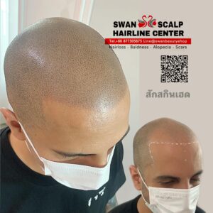 สักทรงสกินเฮดH08