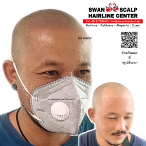 สักทรงสกินเฮดH09