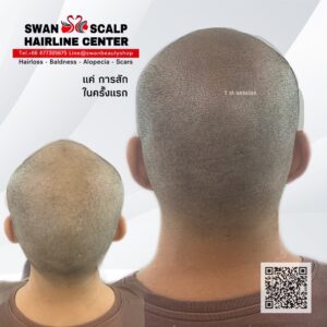 สักสกินเฮดครั้งแรกH05