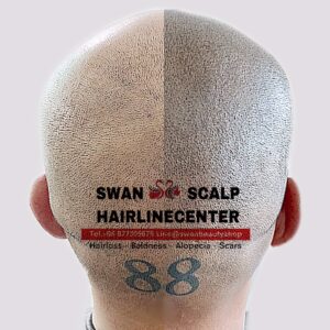 สักหัวล้านเหมือนจริงH01